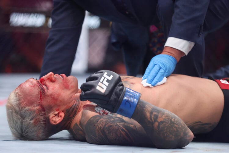 Photo by Ian Maule/Getty Images